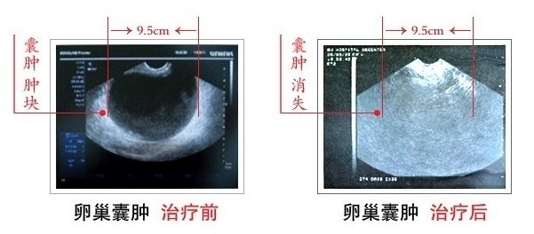 �ѳ���������ǰ��